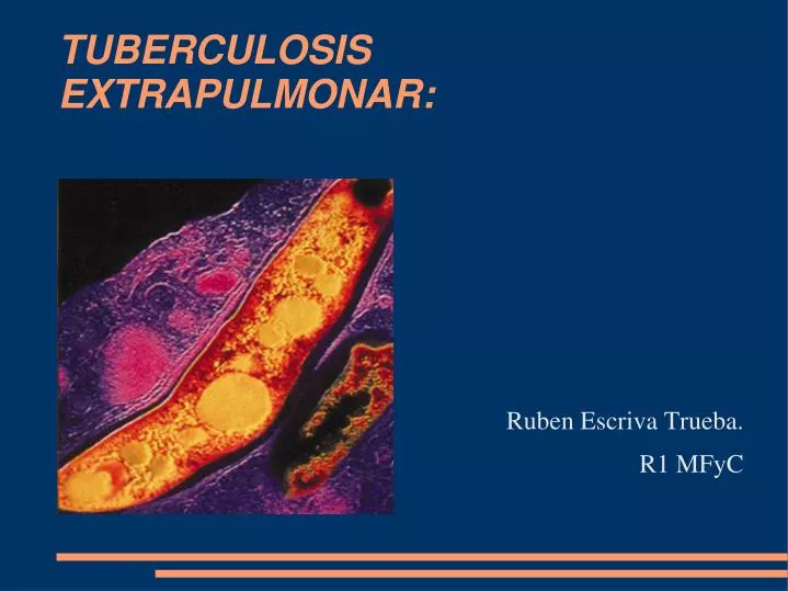 tuberculosis extrapulmonar