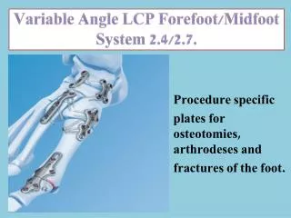 Variable Angle LCP Forefoot/ Midfoot System 2.4/2.7.