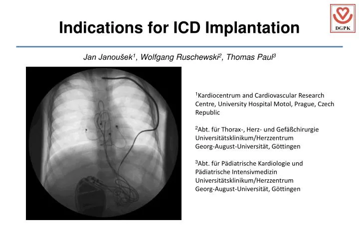 indications for icd implantation