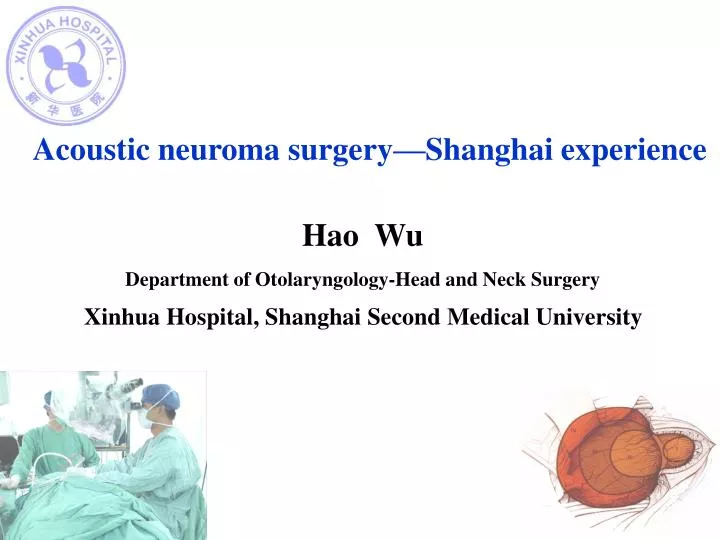 acoustic neuroma surgery shanghai experience