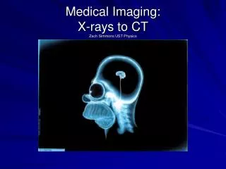 Medical Imaging: X-rays to CT Zach Simmons UST Physics