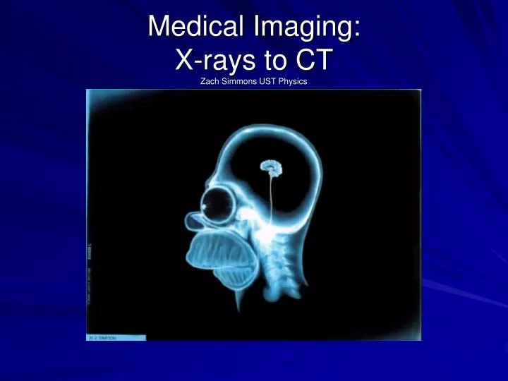 medical imaging x rays to ct zach simmons ust physics