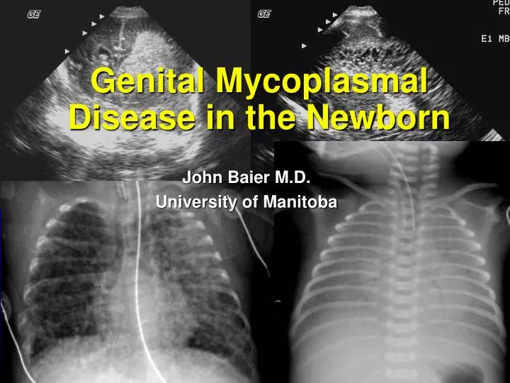 genital mycoplasmal disease in the newborn