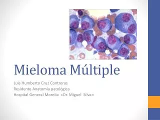 mieloma m ltiple