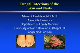 Fungal Infections of the Skin and Nails