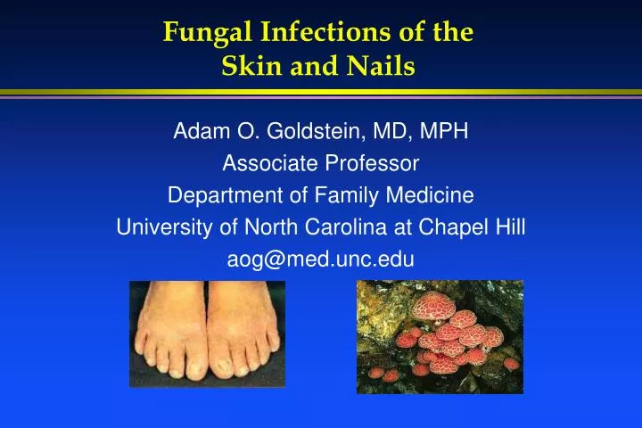 fungal infections of the skin and nails