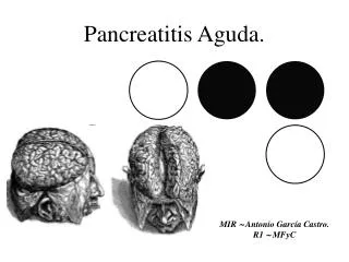 pancreatitis aguda