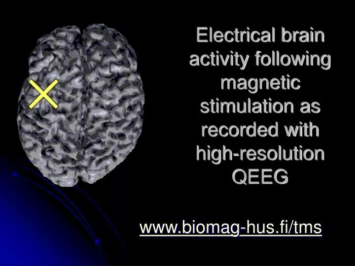 electrical brain activity following magnetic stimulation as recorded with high resolution q eeg