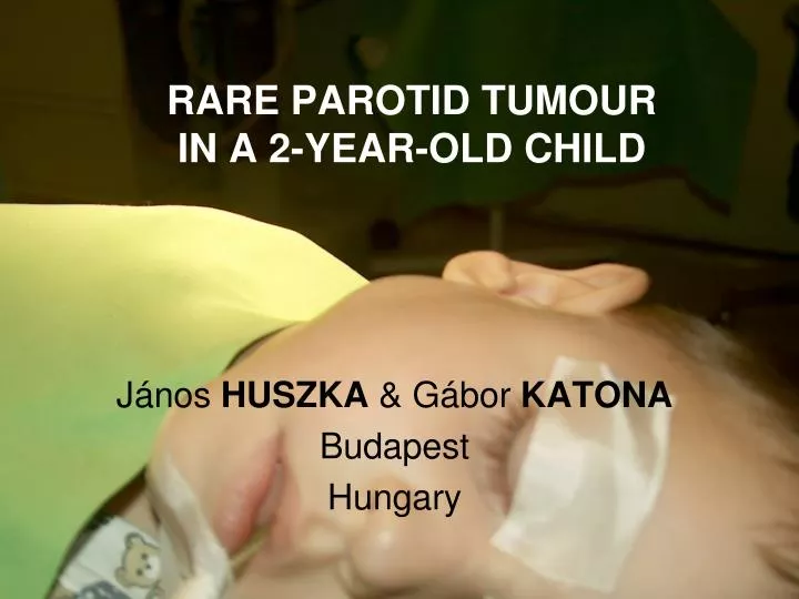 rare parotid tumour in a 2 year old child