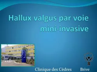 hallux valgus par voie mini invasive