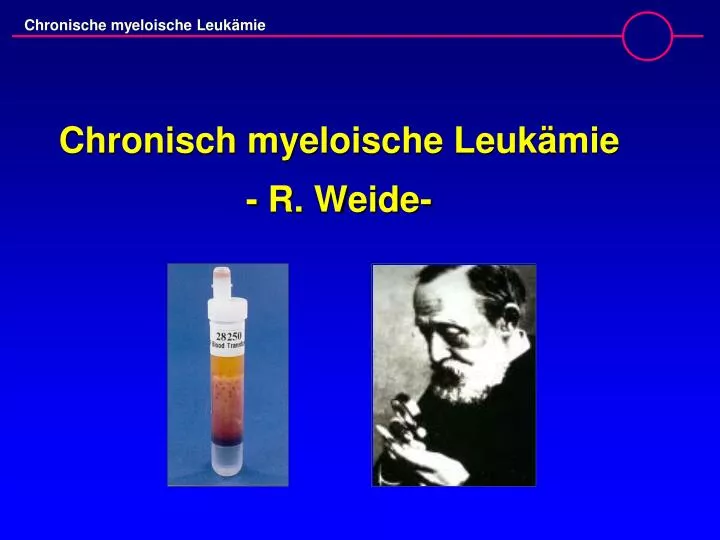 chronisch myeloische leuk mie r weide