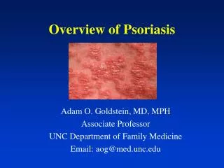 Overview of Psoriasis