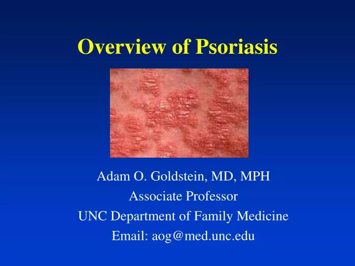 overview of psoriasis