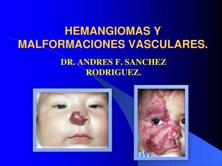 hemangiomas y malformaciones vasculares