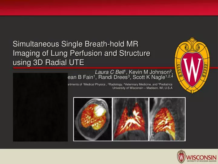 simultaneous single breath hold mr imaging of lung perfusion and structure using 3d radial ute