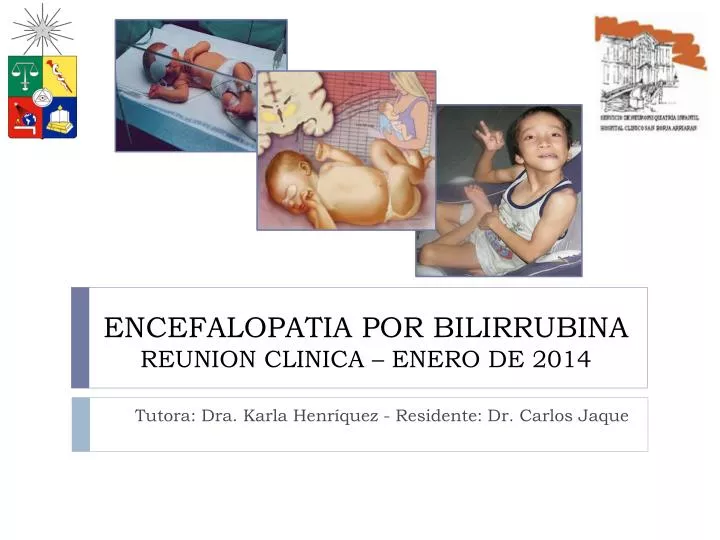 encefalopatia por bilirrubina reunion clinica enero de 2014