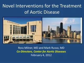 Novel Interventions for the Treatment of Aortic Disease