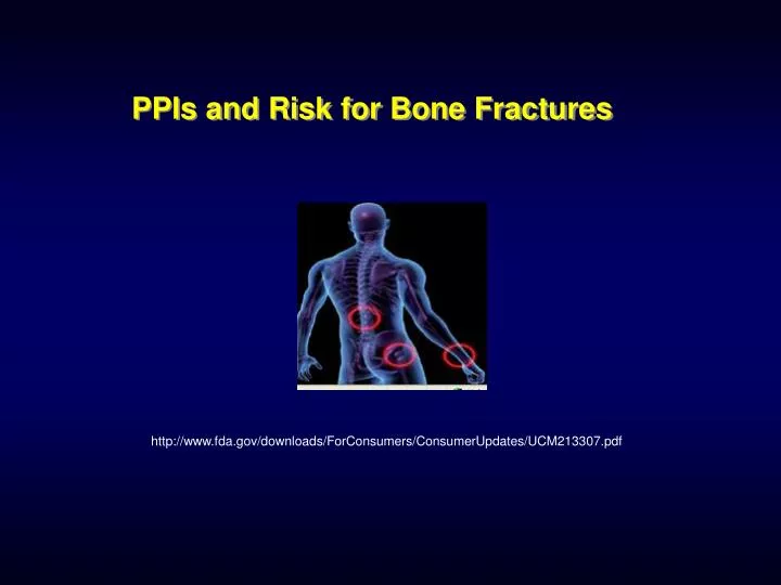 ppis and risk for bone fractures