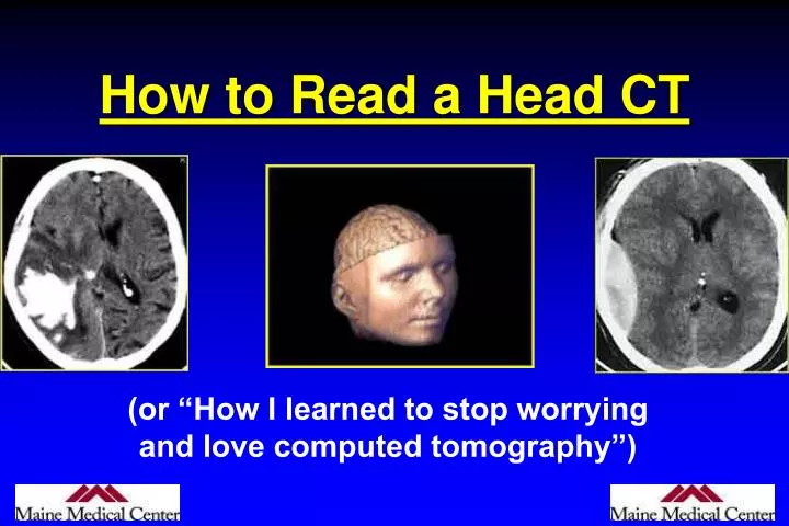 how to read a head ct