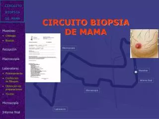 circuito biopsia de mama