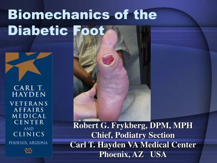 biomechanics of the diabetic foot