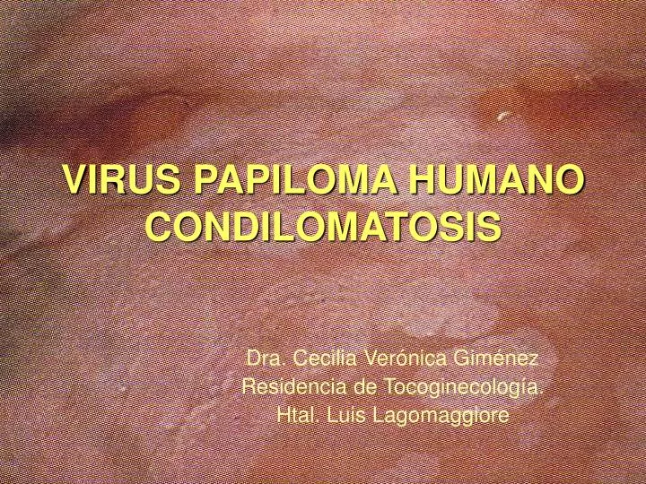 virus papiloma humano condilomatosis