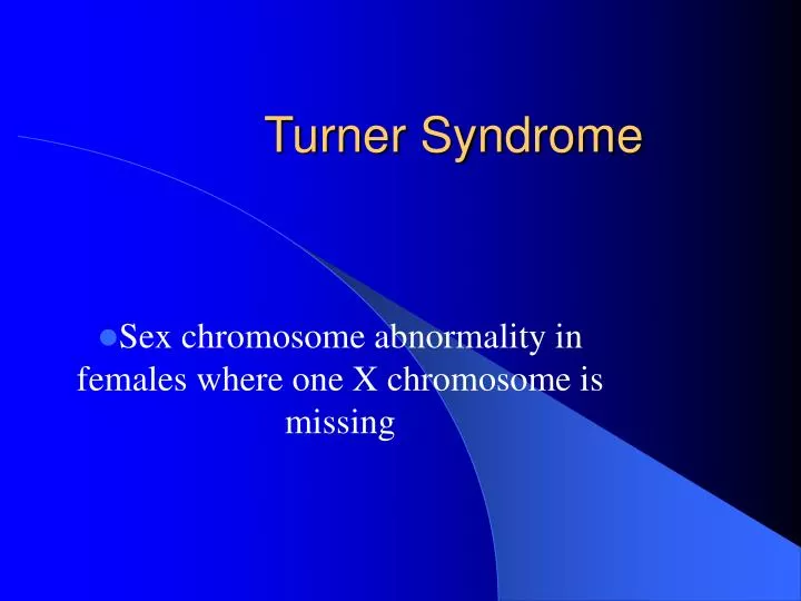 turner syndrome