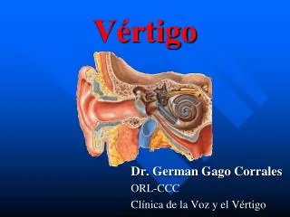v rtigo