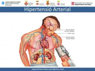 hipertensi arterial