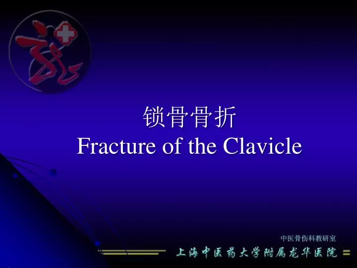 fracture of the clavicle