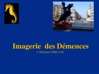 imagerie des d mences c delmaire chru lille