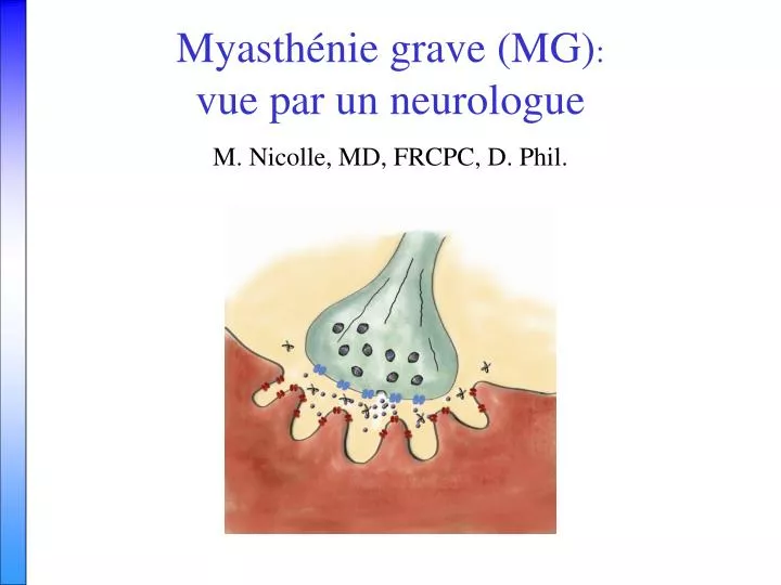 myasth nie grave mg vue par un neurologue