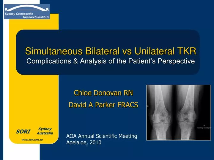 simultaneous bilateral vs unilateral tkr complications analysis of the patient s perspective