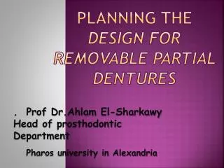 Planning the design for removable partial dentures