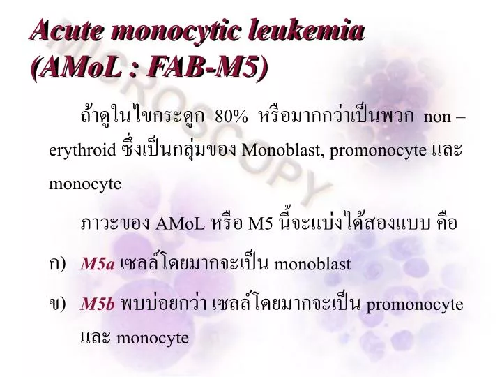 acute monocytic leukemia amol fab m5