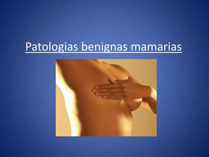 patologias benignas mamarias