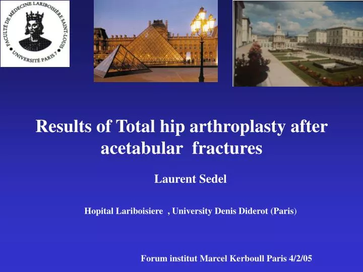 results of total hip arthroplasty after acetabular fractures