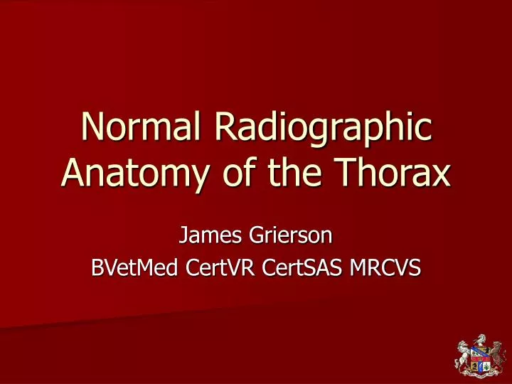normal radiographic anatomy of the thorax