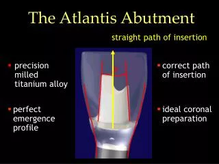 The Atlantis Abutment