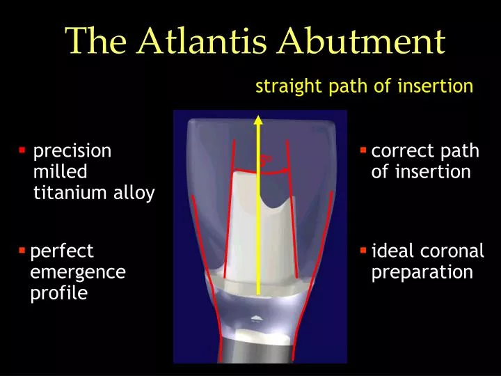 the atlantis abutment
