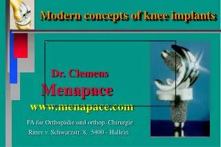 Modern concepts of knee implants