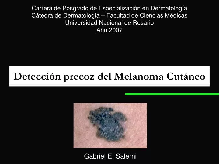 detecci n precoz del melanoma cut neo