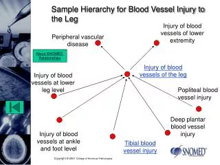 Sample Hierarchy for Blood Vessel Injury to the Leg