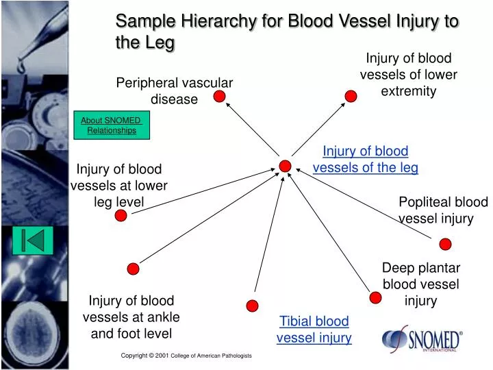sample hierarchy for blood vessel injury to the leg
