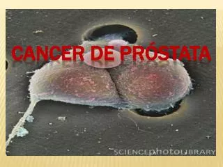 cancer de pr stata