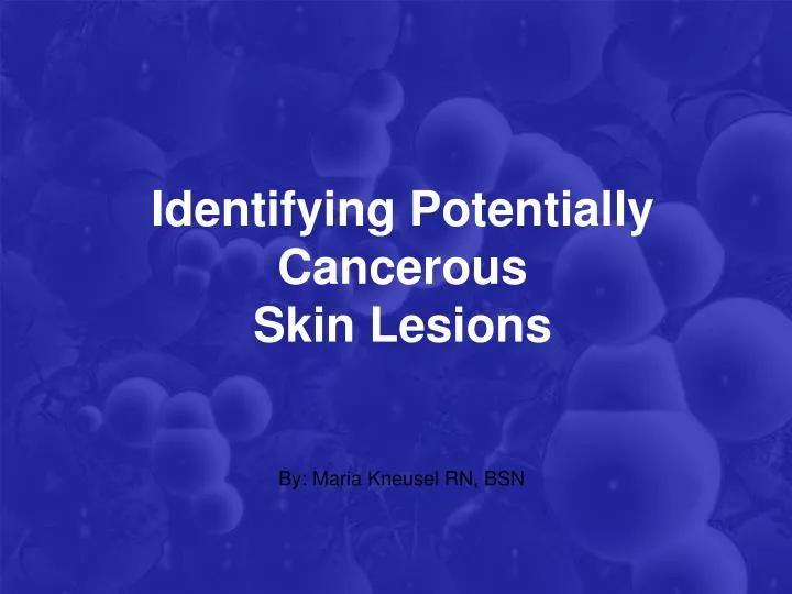 identifying potentially cancerous skin lesions