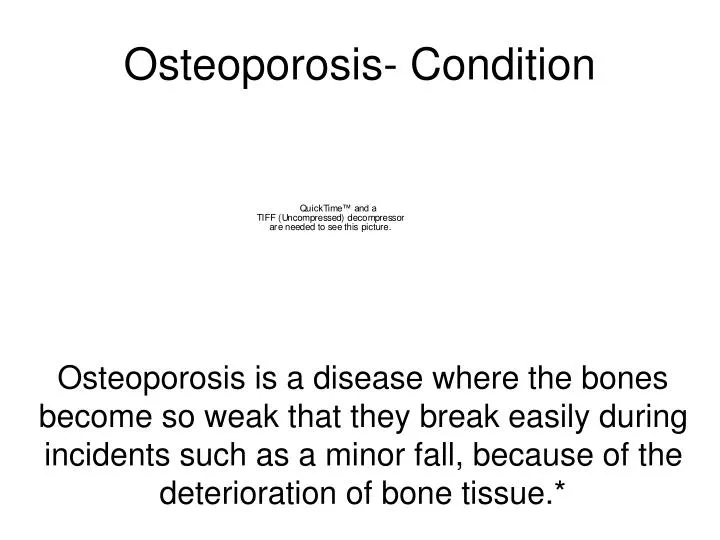 osteoporosis condition