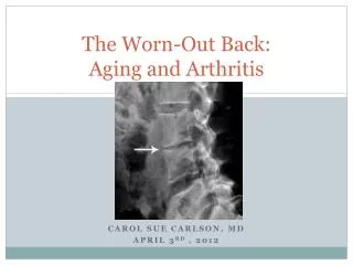 The Worn-Out Back: Aging and Arthritis