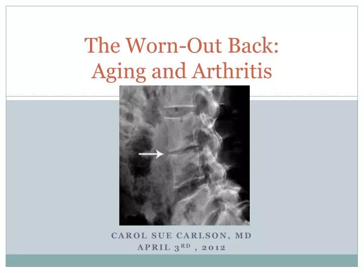the worn out back aging and arthritis