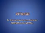 VITILIGO - slide 1